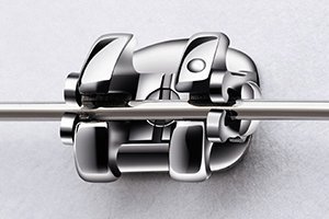 Брекеты Smartclip Брекеты Smartclip.jpg